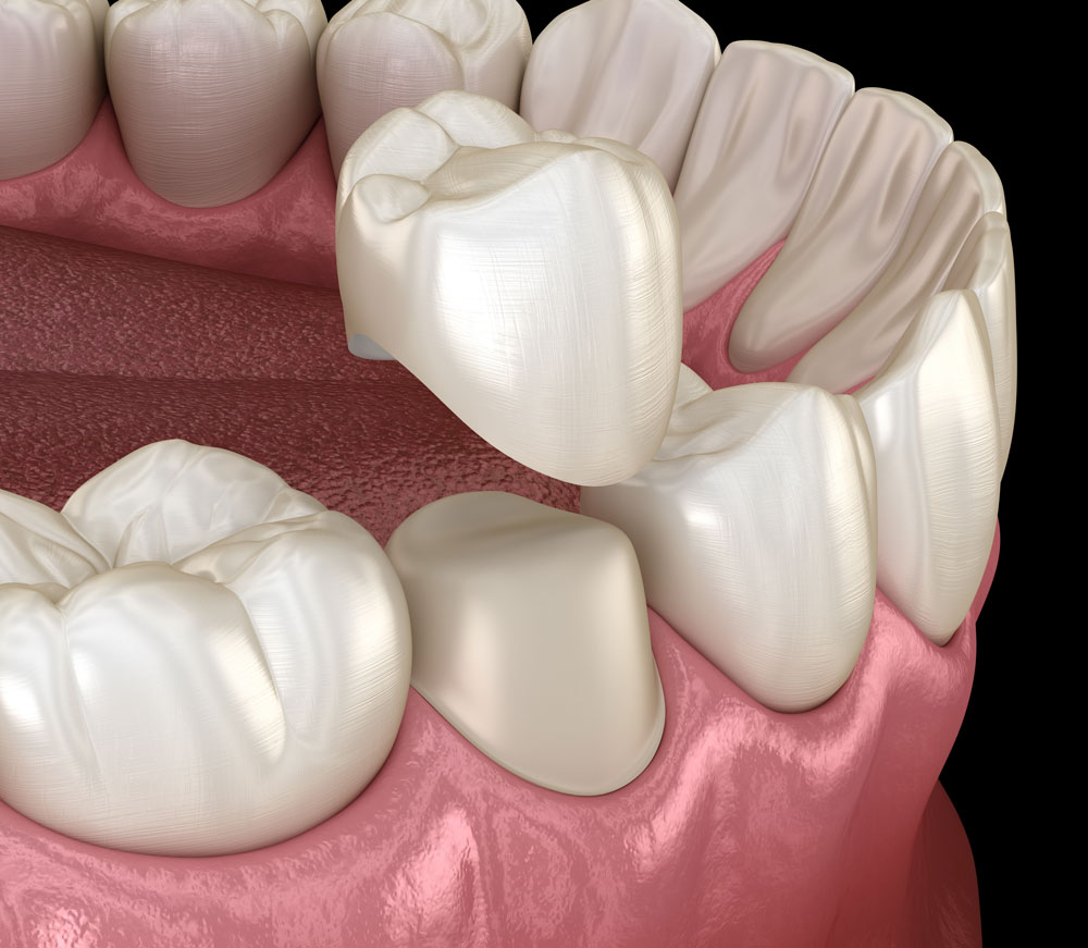 General and preventive dentistry